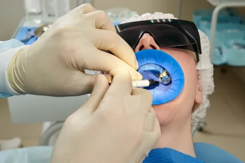 Cyrkon – zastosowanie w stomatologii